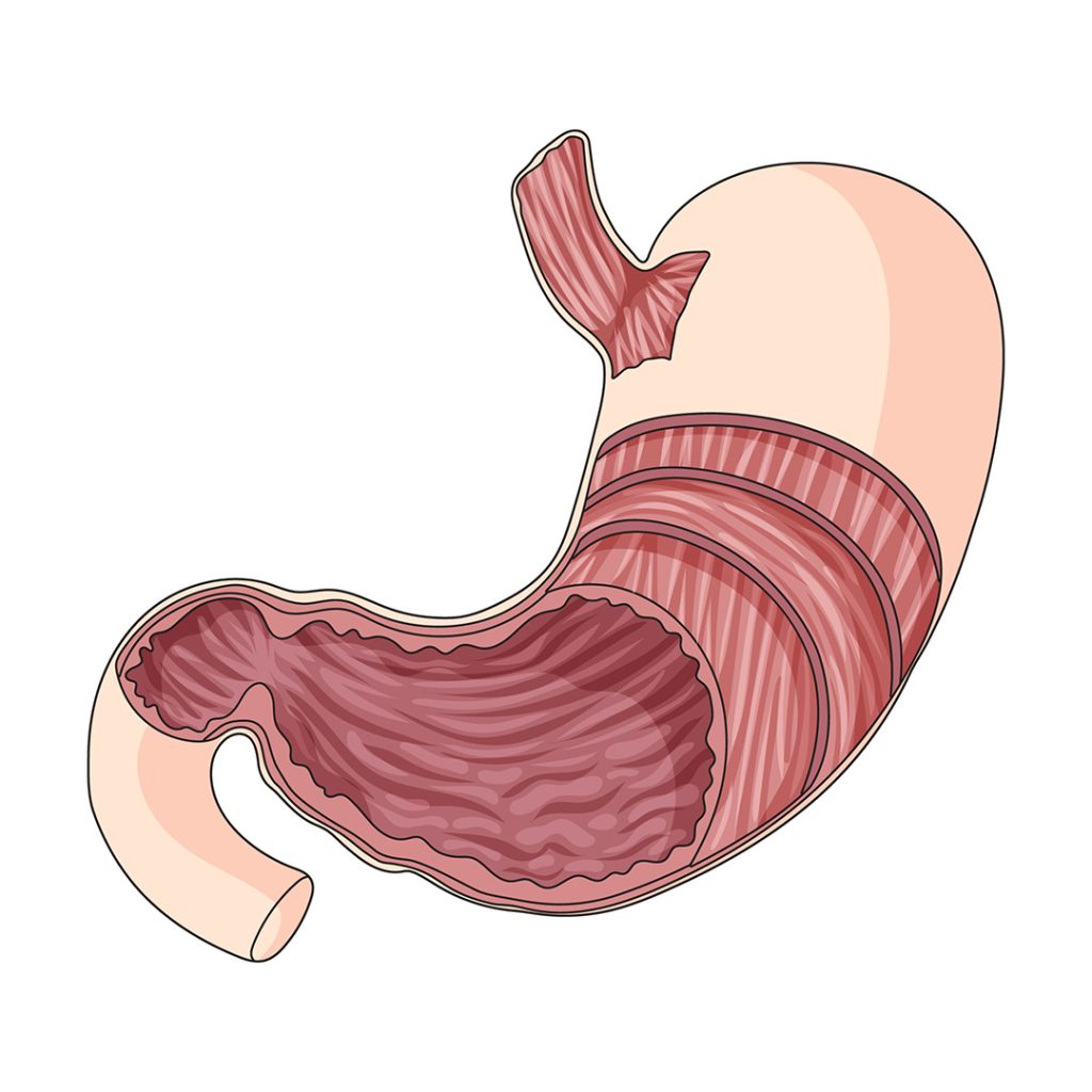 endoscopie